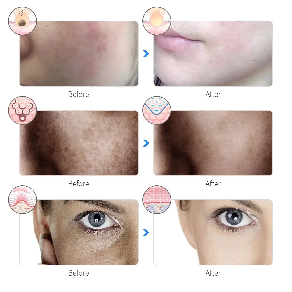 Radiant Glow LED Beauty Mask